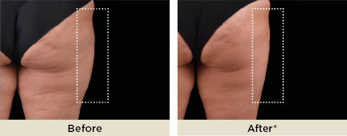 BA_thumbnail_saddle3