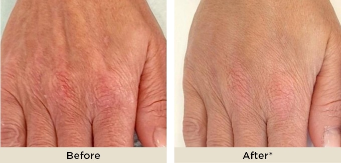 pr_hands_before