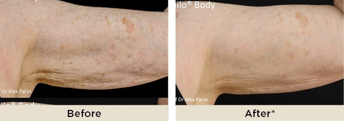 pro_body_ba2
