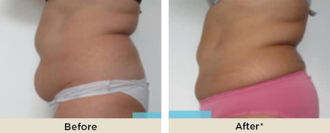 BA_thumbnail_cristal_new