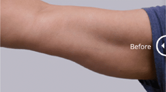 Cristal-Pro-2-Before