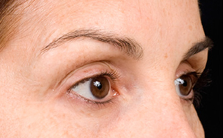 Non-surgical-7-after