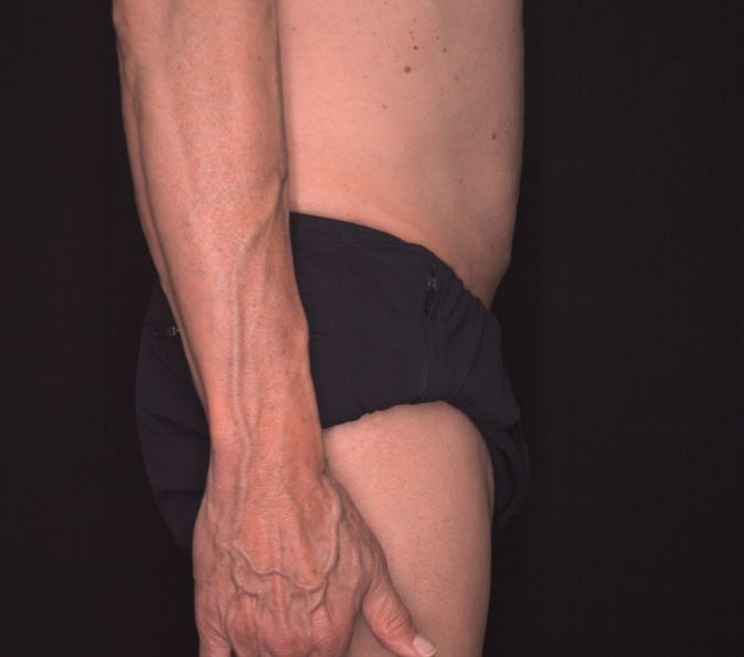 Abdominal-Dr-Greg-Mueller-After-4-sessions-page-114