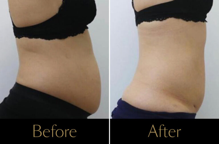 Emerald-Before–After2-2