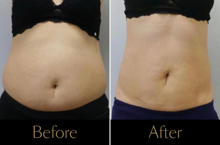 Emerald-Before–After3-2