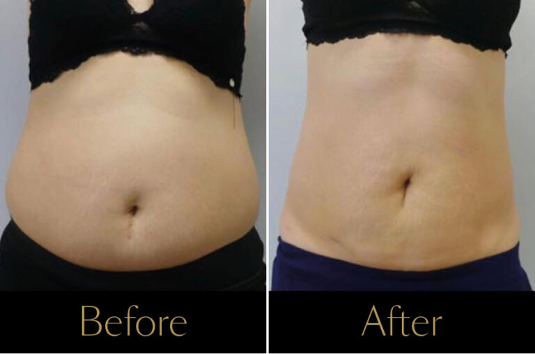 Emerald-Before–After3