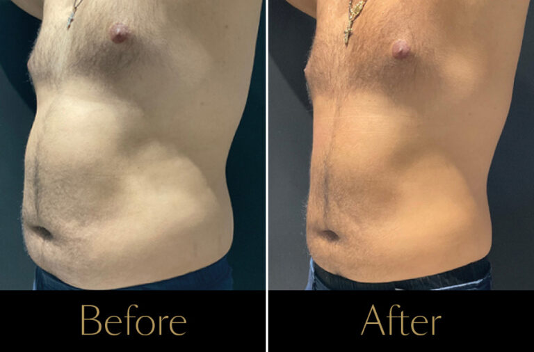 Emerald-Before–After5-2