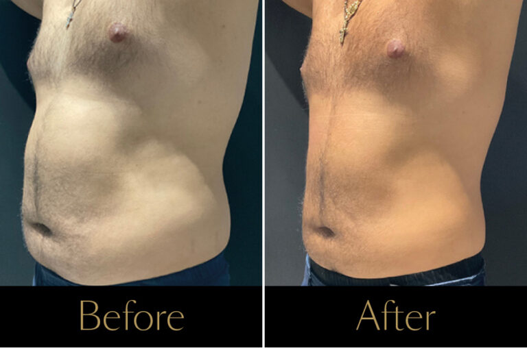 Emerald-Before–After5