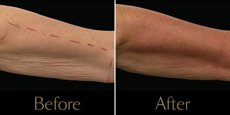 Rakus-Exilis-Gallery14