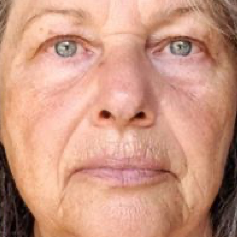 Rakus-beforeafter-advatx6