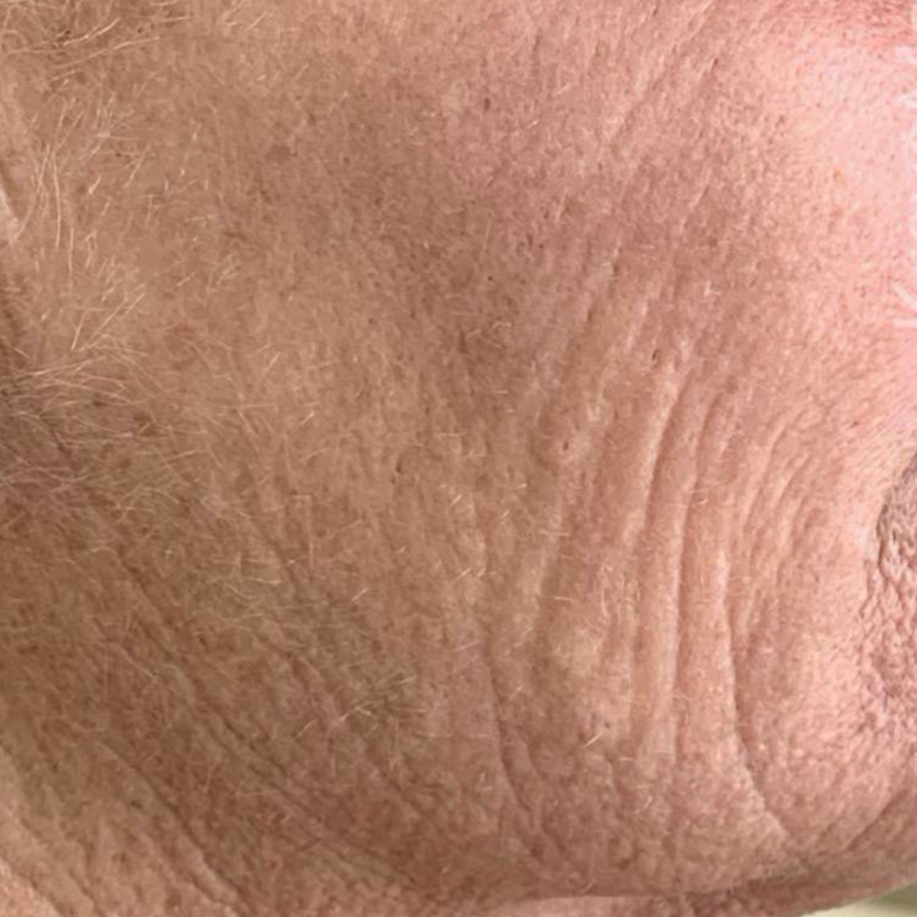 Rakus-beforeafter-advatx7