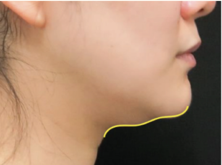 Ultracel Q+ Rakus Clinic