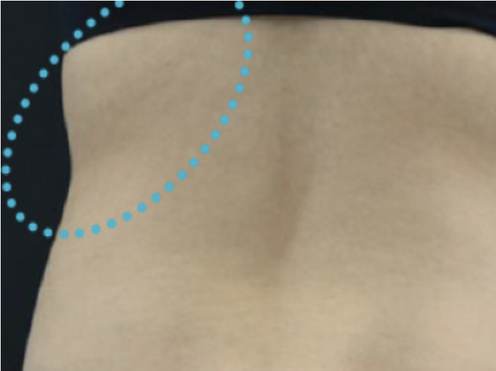 Ultracel Q+ Rakus Clinic