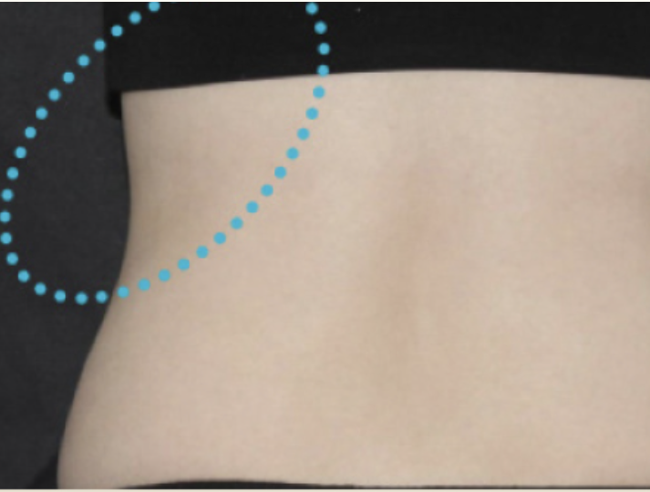 UltracelQ+ - Rakus Clinic