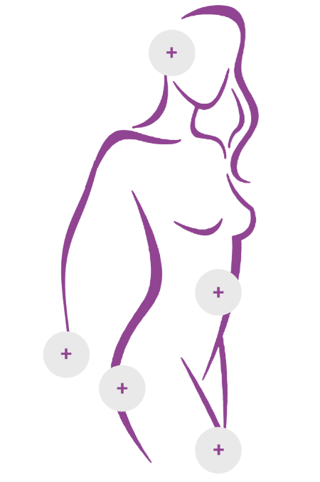 rakus-thermage-areas