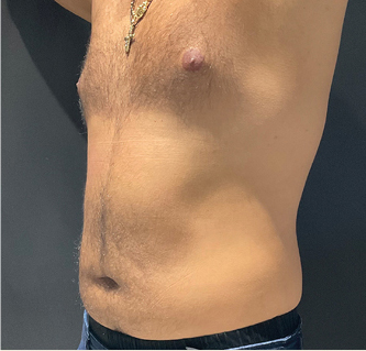 emerald_ba5-after-after