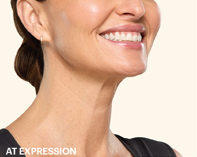 rakus-botox-gallery2