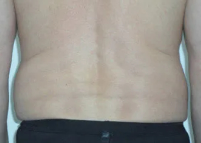 rakus-cristalpro-beforeafter