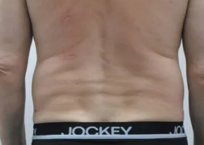 rakus-cristalpro-beforeafter2