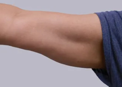 rakus-cristalpro-beforeafter3