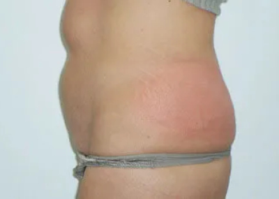 rakus-cristalpro-beforeafter6