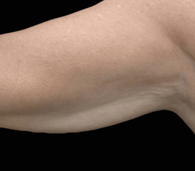 rakus-exion-beforeafter6