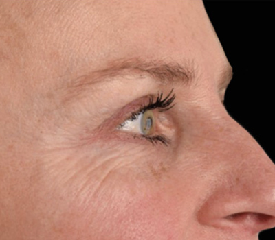 rakus-exion-beforeafter7