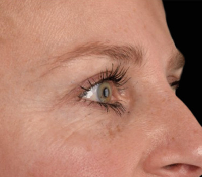 rakus-exion-beforeafter8