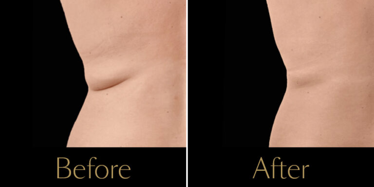 rakus-exion-gallery10