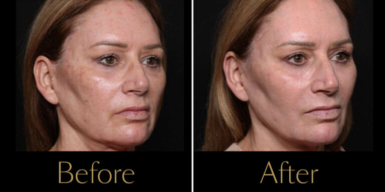 rakus-exion-gallery2