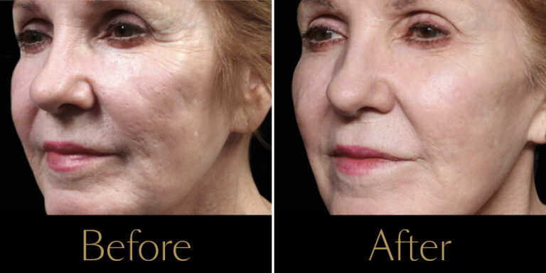 rakus-exion-gallery4