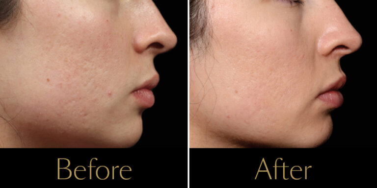 rakus-exion-gallery6