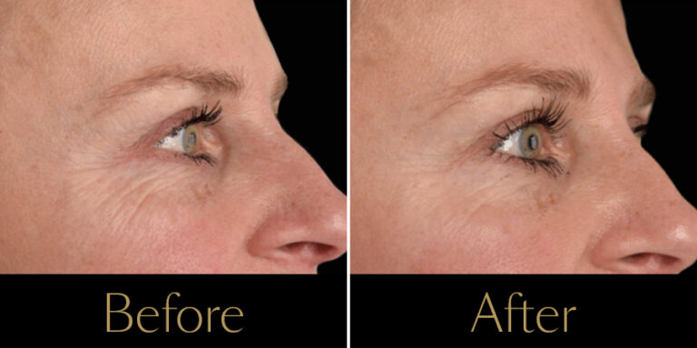 rakus-exion-gallery7