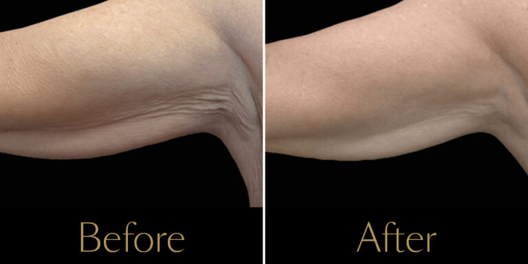 rakus-exion-gallery8