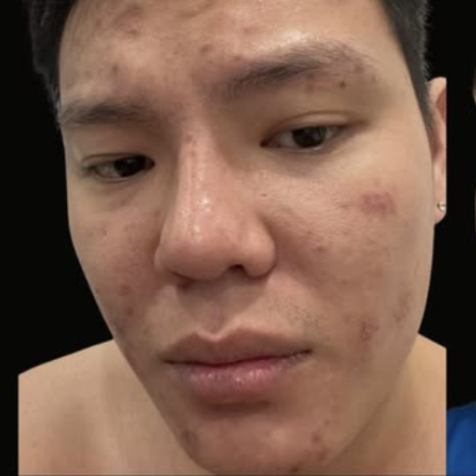 rakus-exosomes-gallery-new