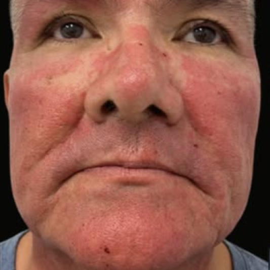 rakus-exosomes-gallery-new3