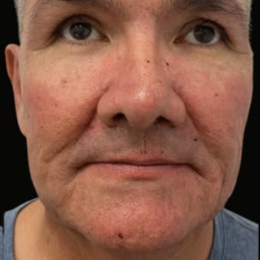 rakus-exosomes-gallery-new4