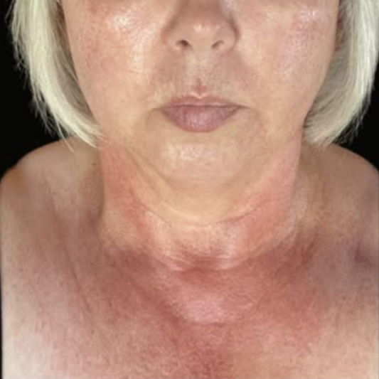 rakus-exosomes-gallery-new5