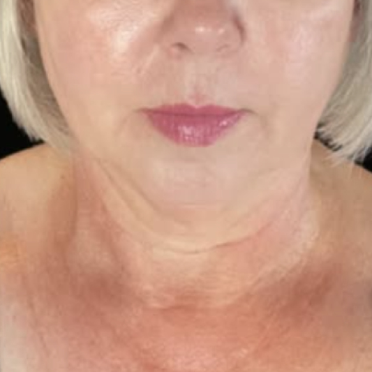 rakus-exosomes-gallery-new6