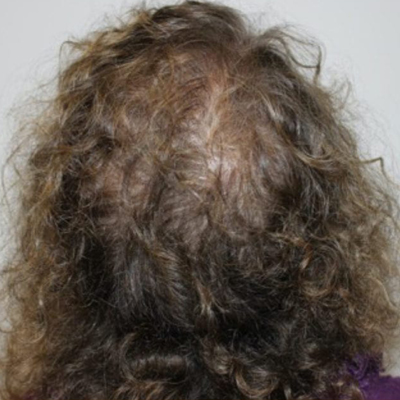 rakus-keravive-beforeafter3