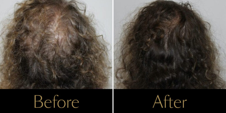 rakus-keravive-gallery