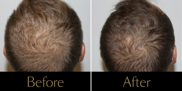 rakus-keravive-gallery2