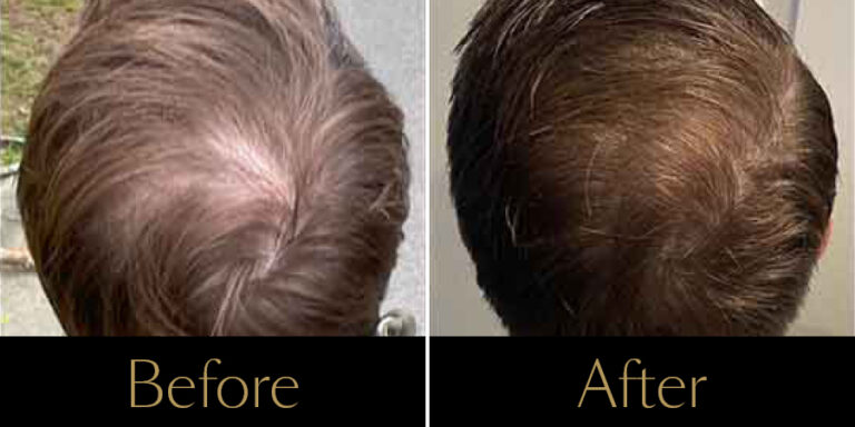 rakus-keravive-gallery3