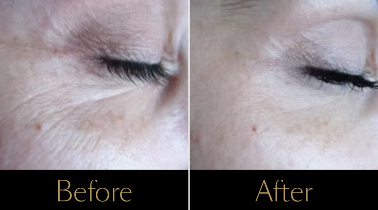 rakus-pelleve-gallery-new