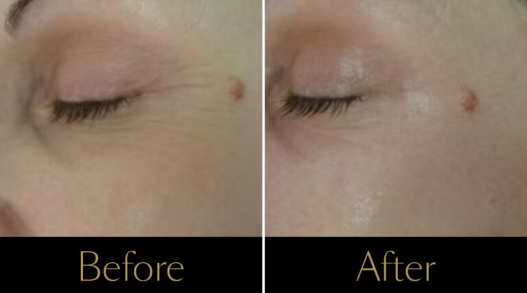 rakus-pelleve-gallery-new2