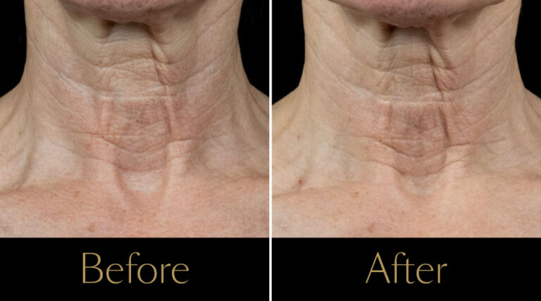 rakus-polyphil-gallery