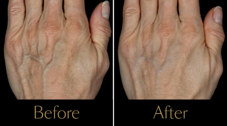 rakus-polyphil-gallery2