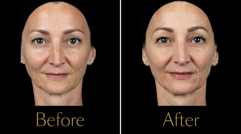 rakus-polyphil-gallery3