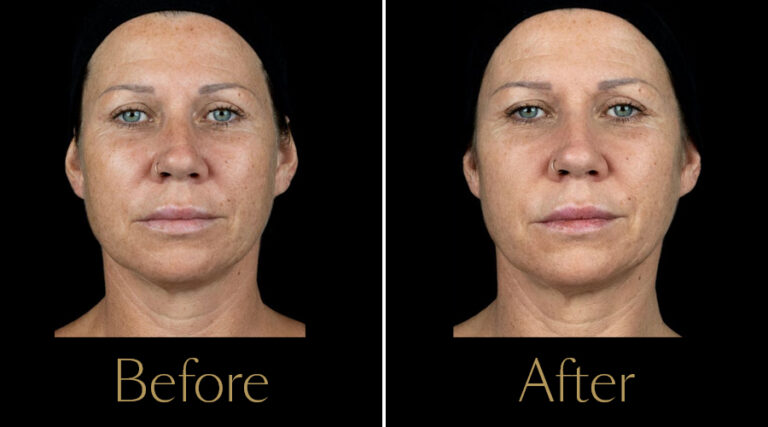 rakus-polyphil-gallery4