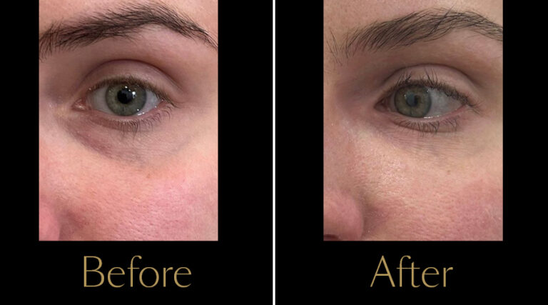 rakus-polyphil-gallery5